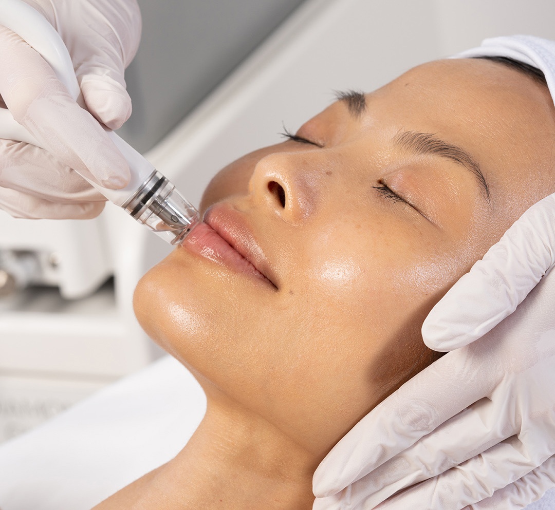 asian woman recieving diamond glow treatment on face asian woman recieving diamond glow treatment on face