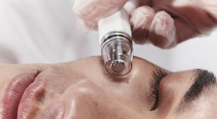 man recieving diamond glow treatments on face man recieving diamond glow treatments on face