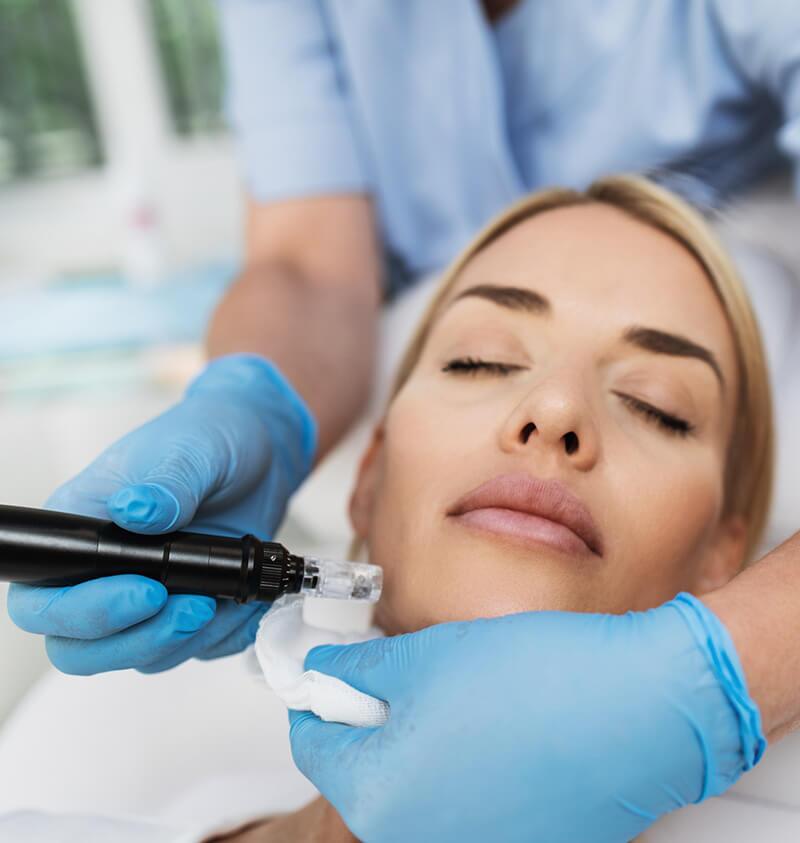 Microneedling In NYC Microneedling In NYC<br />