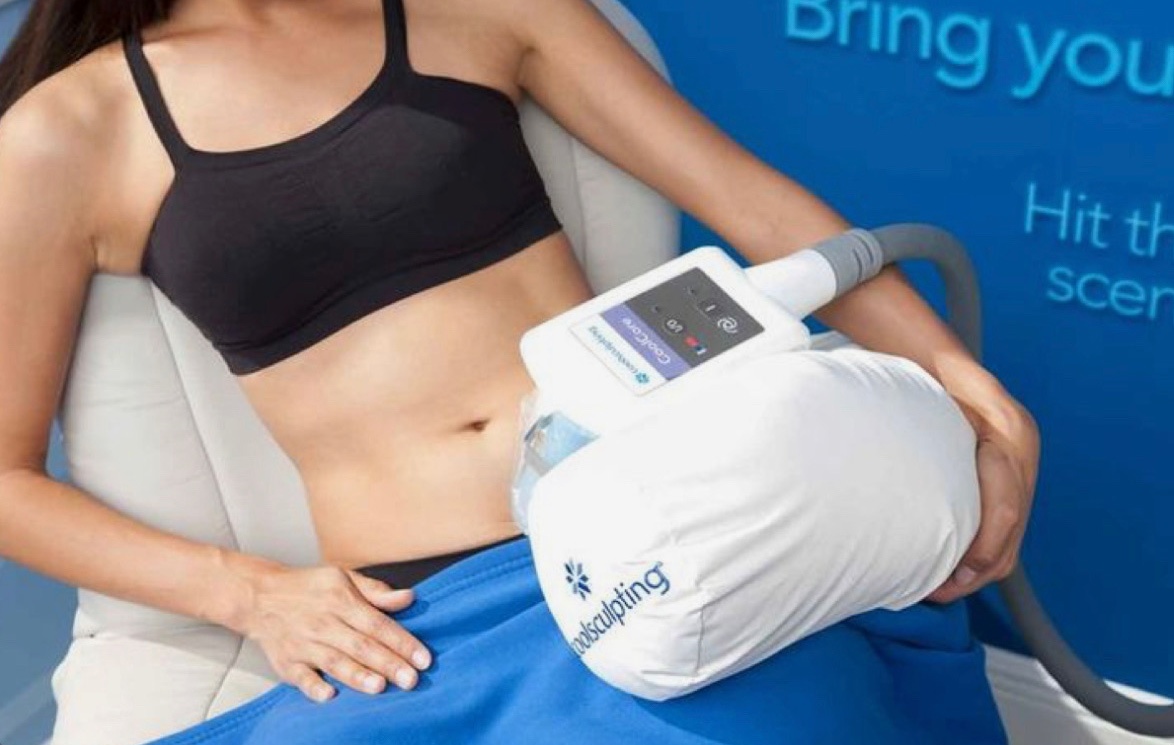 coolsculpting procedure woman image
