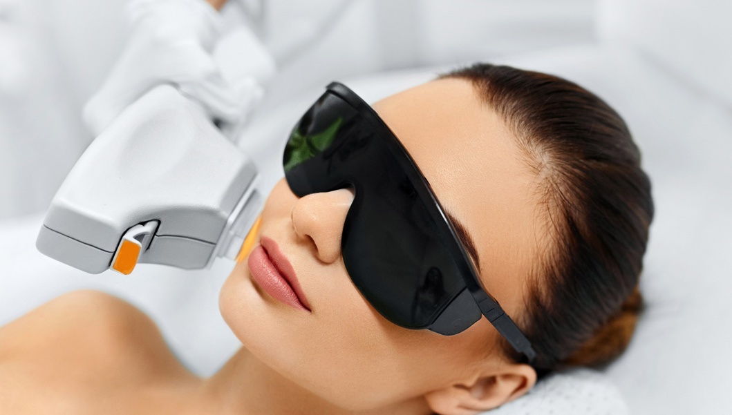 ipl photofacial treatment on side of womans face v ipl photofacial treatment on side of womans face v