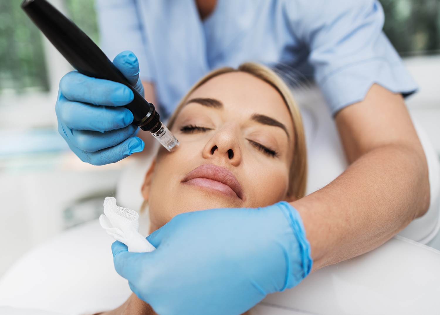 Beautiful blond woman receiving microneedling Beautiful blond woman receiving microneedling